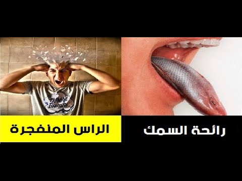 شاهد 13 مرضًا غريبًا لم تكن تعرفهم