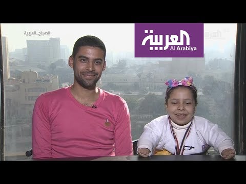 لقاء طريف مع طفلة مصرية تحدت الاعاقة