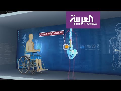 شاب يستعيد القدرة على المشي بفضل قطب كهربائي