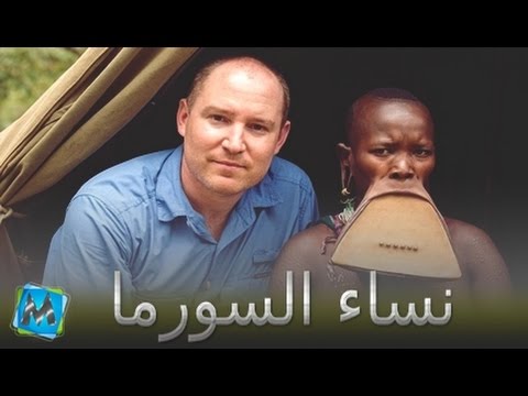 نساء يمتلكن أكبر أفواه في العالم