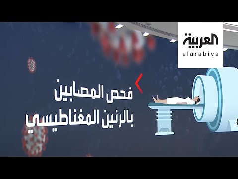 شاهد دراسة تكشف حقائق جديدة حول تأثيرات خطيرة لـكورونا على الجسم