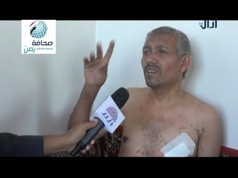 يمني يعود إلى الحياة بعد إعدامه رميًا بالرصاص