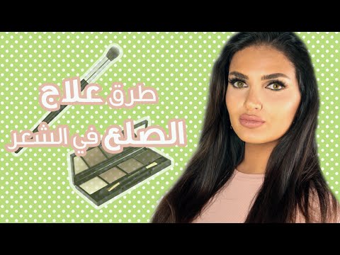 تعرف على طرق مضمونة لعلاج الصلع