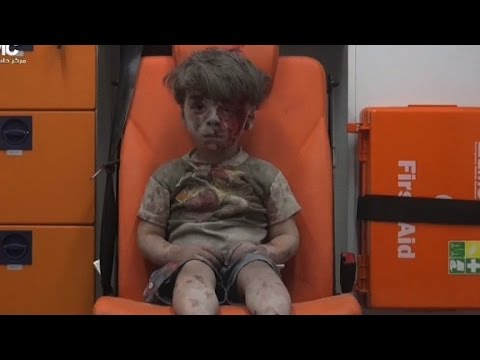 syrian boy reminds us of another horrific image